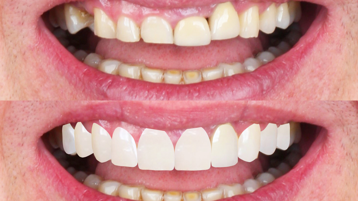 Novos Caminhos da Odontologia Estética