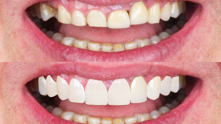 Novos Caminhos da Odontologia Estética