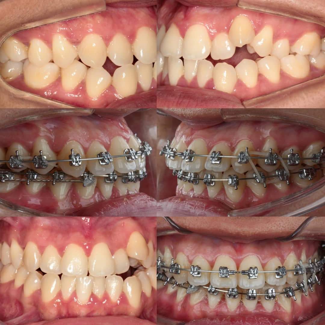 Dentistas na Odontotim