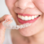 Invisalign: Alinhamento Dental Discreto com a Odontotim